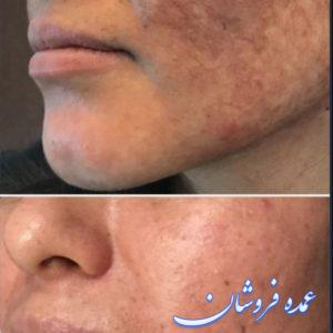 فروش انواع محصولات پوست و مو به صورت تک و عمده